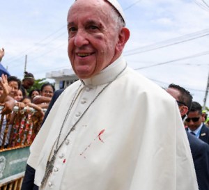 francis-bruised-wounded